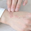 夏なのに乾燥？肌と体の「かくれ乾燥」に気づいていますか