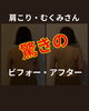 「驚きの」変化！長年の肩こり＆むくみ解消「肩こり・むくみさんのビフォーアフターと、お客様の声」