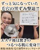 お客様の乾燥「毛穴の黒ずみ撃退！！」