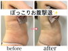 短期間で確かな結果を実感!「ぽっこりお腹＆ウエストライン集中ケア＊横からの“厚み”変化」