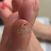 小指の爪横が硬い方、見てください!!副爪になる人3選👣足トラブルに特化したフットケアサロン👣大阪駅・梅田駅から2駅にある個室サロン🏡野田阪神からすぐ🚃