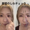 眉間のしわが気になる方へ〜おうちでできる簡単マッサージ