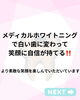 「ホワイトニングで笑顔の印象アップを目指しませんか」