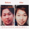 手のひら整顔術のビフォーアフターと、顔・頭・身体までケアできる当店の特徴