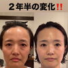 Litで続けた2〜3年の変化をご紹介します
