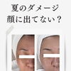夏のダメージ、秋まで持ち越していませんか？Before→Afterのお肌変化