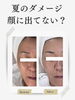 夏のダメージ集も変化！素肌へ導く「夏のダメージ、秋まで持ち越していませんか？Before→Afterのお肌変化」