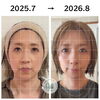 1年後のビフォーアフターで見るお顔と肌の変化