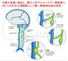 「アルツハイマー病と「脳のリンパ流」をめぐる新しい外科手術」