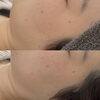 むくみもスッキリし輪郭も美しく若々しく【福井フェイシャルサロン/福井フェイシャルエステ/福井むくみケア】