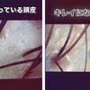✨髪育✨　髪を育てるには…