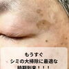 WhiteLABシミケアモニター3名さま募集のお知らせ