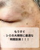 「WhiteLABシミケアモニター3名さま募集のお知らせ」