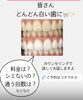 「どんどん白い歯に！劇的変化のメディカルホワイトニング症例」
