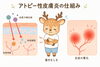 今日も定番の鹿さん「アトピーその２　ちょっとマニアックです。」
