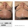あらゆる肌トラブルに♪光フェイシャルでつるんと明るい素肌へ【脱毛サロン/メンズ脱毛/光フェイシャル/大在】