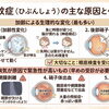 視界に小さな虫が飛んで見えたら？飛蚊症と受診の目安について