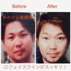店主ビフォーアフター公開！週1ペースで続けた「手のひら整顔術」と和歌山出張所のご案内