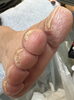施術前の足🦶「男性でもお悩みあります💦」