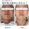 首元が変わればお肌も変わる＊首から整えるソニックエステ