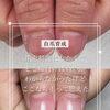 勇気を出してご来店【福井/自爪育成】