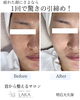 「1回で変わる顔、12回で変わる横顔＊首から整えるソニックエステ」
