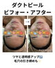 「肌の調子抜群！今までで一番！ダクトピールの嬉しいご感想」