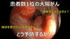 「胃がん、大腸がんの予防について」