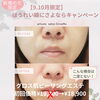 9・10月限定♪新規19,800円が特別価格18,900円に！グロス肌ピーリングエステ