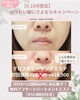 期間限定！グロス(光沢)肌ピーリングエステ「9・10月限定♪新規19,800円が特別価格18,900円に！グロス肌ピーリングエステ」