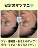 「夏の肌汚れはクレンジングと洗顔だけでは落ちません！毛穴のトラブルならマツヤニ一択！」