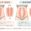 産後に腹筋を始めて腰が痛くなった方へ。腹直筋離開をセルフチェック