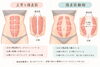 腹直筋の変化「産後に腹筋を始めて腰が痛くなった方へ。腹直筋離開をセルフチェック」