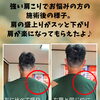 強い肩こりでお悩みの方へ。施術後に肩の盛り上がりがスッと改善しました【新潟市東区 整体】