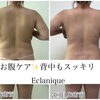 お腹ケアで背中もすっきりした印象へ＊複数回施術の経過をご紹介
