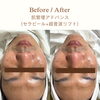 肌管理BASICとADVANCEの違い。60分・90分で考える肌悩みに合わせた選び方