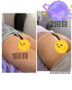 「NRnineで、身体の状態に合わせた筋膜リリース」