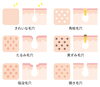 さまざまな毛穴「毛穴が目立つのは、汚れが詰まっているから？」