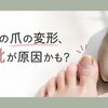 その爪の変形、靴が原因かも？