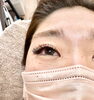 「下向きまつげもぱっちり上向きに｜LEDエクステ×アンドヘルシーで華やかな目元へ」