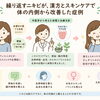 生理前に悪化するニキビ。便秘やホルモンバランスにも着目して体質改善した症例