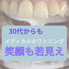 30代からの若見えには口元の清潔感がカギ！笑顔を明るく彩るメディカルホワイトニング