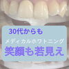30代からの若見えには口元の清潔感がカギ！笑顔を明るく彩るメディカルホワイトニング