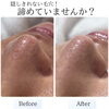 頑固な毛穴黒ずみ・イチゴ鼻にさようなら＊首から整えるつるんと魅せ肌ケア