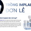 Trồng Răng Implant Giá Bao Nhiêu? Tham Khảo Chi Phí Implant Đơn Lẻ Tại Smilux Dental