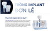 「Trồng Răng Implant Giá Bao Nhiêu? Tham Khảo Chi Phí Implant Đơn Lẻ Tại Smilux Dental」