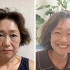 小顔調整を継続して実感する、フェイスラインのすっきり感と若々しい表情