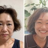 小顔調整を継続して実感する、フェイスラインのすっきり感と若々しい表情