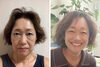 「小顔調整を継続して実感する、フェイスラインのすっきり感と若々しい表情」