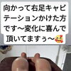 宇都宮市平出町 Angel Rose｜足の重だるさやラインが気になる方へ キャビテーションによる施術事例のご紹介